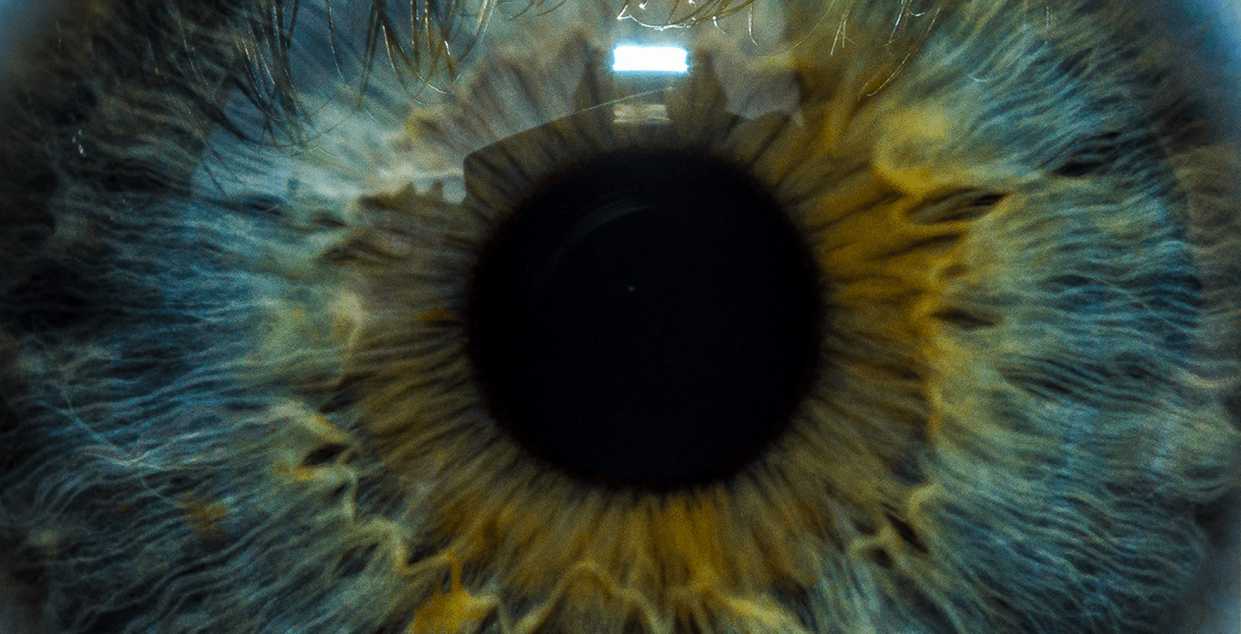 Image of an eye